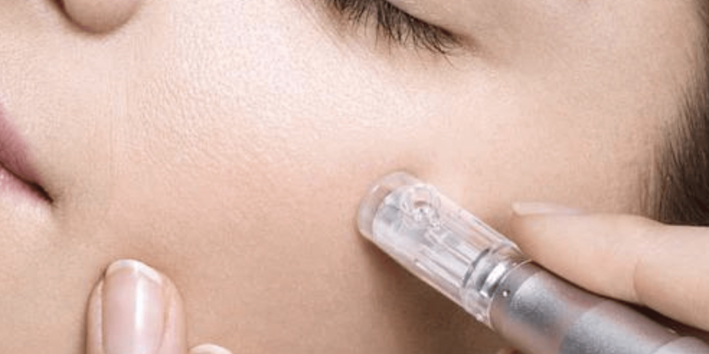 Best Serums for Microneedling: Why V-Tech Stands Out