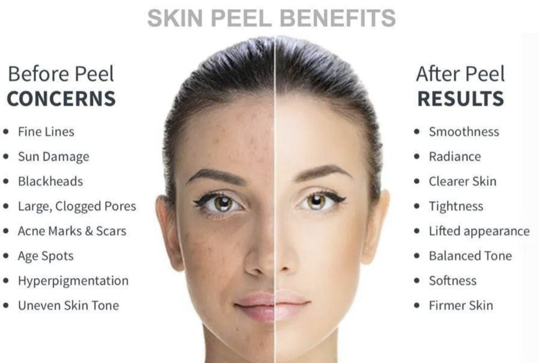 What Are Chemical Peels? Benefits, Types, and What to Expect