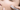 Best Serums for Microneedling: Why V-Tech Stands Out