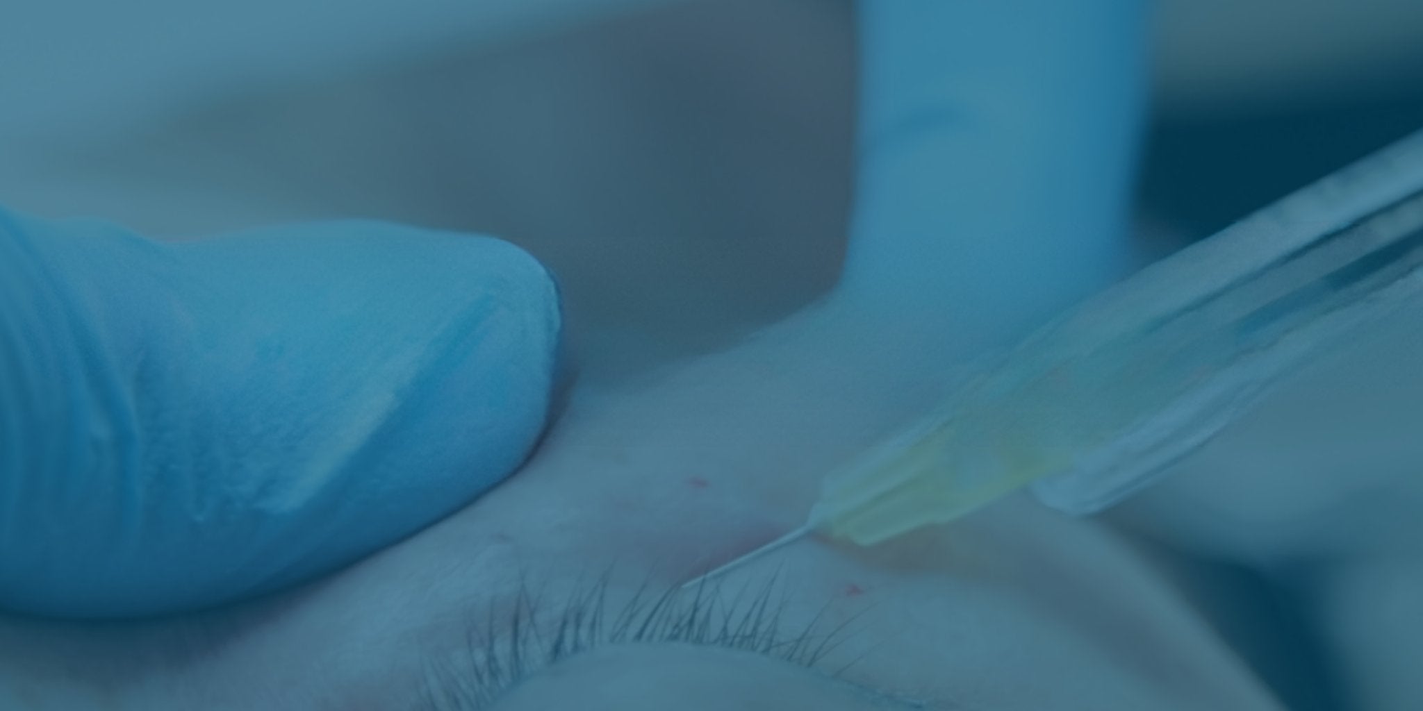 Dermal Fillers